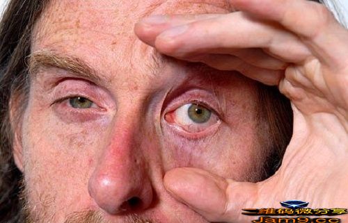 人类最长不睡觉记录：连续40天不睡觉(图3)